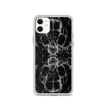 Feverdream iPhone Case