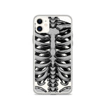 Skeletal iPhone Case