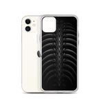 Vertibrae iPhone Case