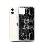 Feverdream iPhone Case