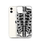 Skeletal iPhone Case