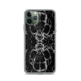 Feverdream iPhone Case