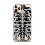 Skeletal iPhone Case