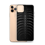 Vertibrae iPhone Case