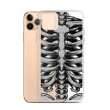 Skeletal iPhone Case