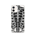 Skeletal iPhone Case