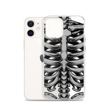 Skeletal iPhone Case