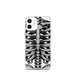 Skeletal iPhone Case