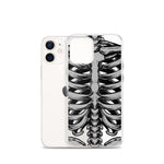 Skeletal iPhone Case