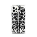 Skeletal iPhone Case