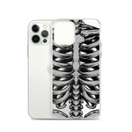 Skeletal iPhone Case