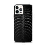 Vertibrae iPhone Case