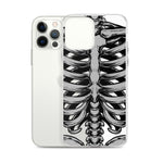 Skeletal iPhone Case