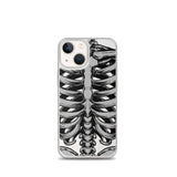 Skeletal iPhone Case