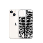 Skeletal iPhone Case