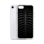 Vertibrae iPhone Case