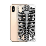 Skeletal iPhone Case