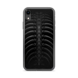 Vertibrae iPhone Case