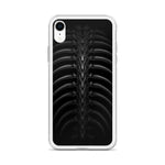 Vertibrae iPhone Case