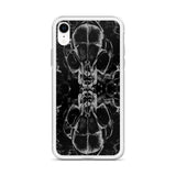 Feverdream iPhone Case