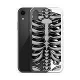 Skeletal iPhone Case