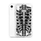 Skeletal iPhone Case