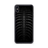 Vertibrae iPhone Case