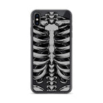 Skeletal iPhone Case