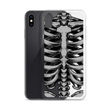 Skeletal iPhone Case