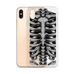 Skeletal iPhone Case